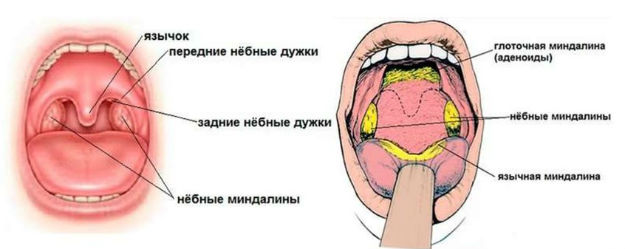 Зачем удаляют гланды и можно ли обойтись без этого?