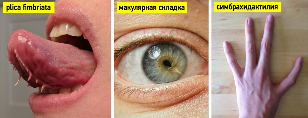Уникальные люди: 22 фотографии с диагнозами