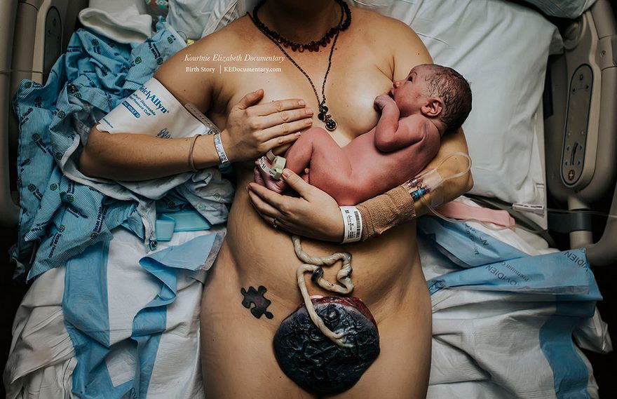 professional-birth-photography-competition-winners-labor-2017-58-58b02c1e77f40__880