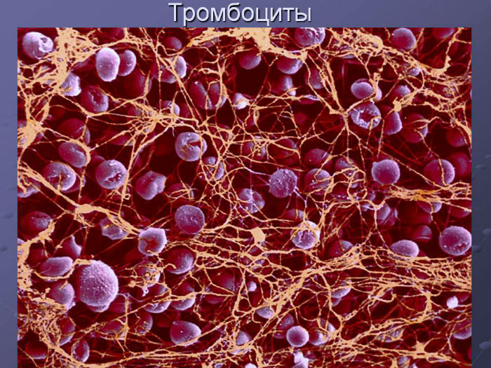 0036-036-Trombotsity