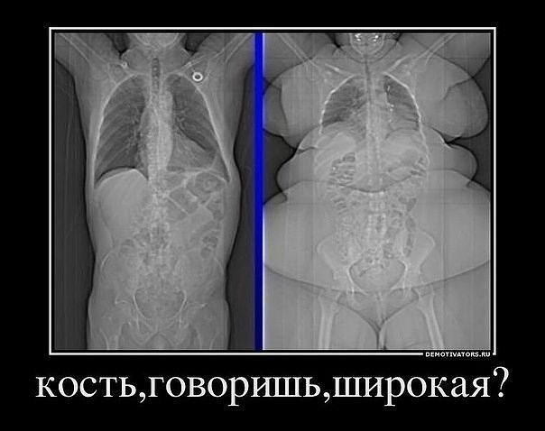 широкая кость зожник