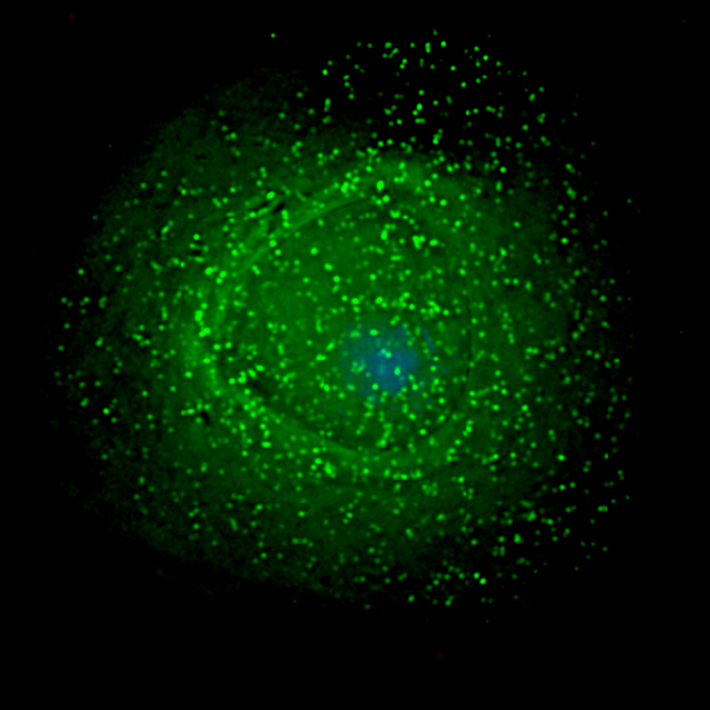 Вирусы на поверхности клетки. Изображение: Reconfirming the Traditional Model of HIV Particle Assembly. Gross L, PLoS Biology Vol. 4/12/2006, e445. doi:10.1371/journal.pbio.0040445