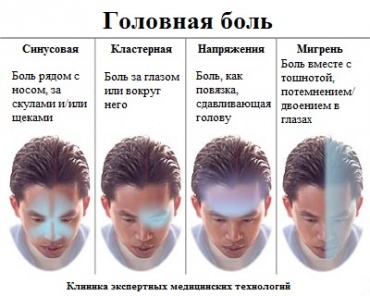виды_головной_боли