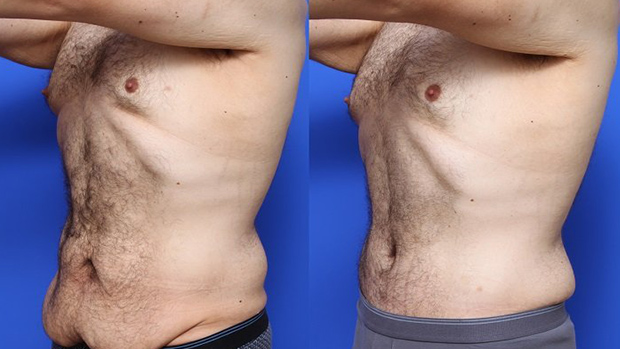 Before-and-After