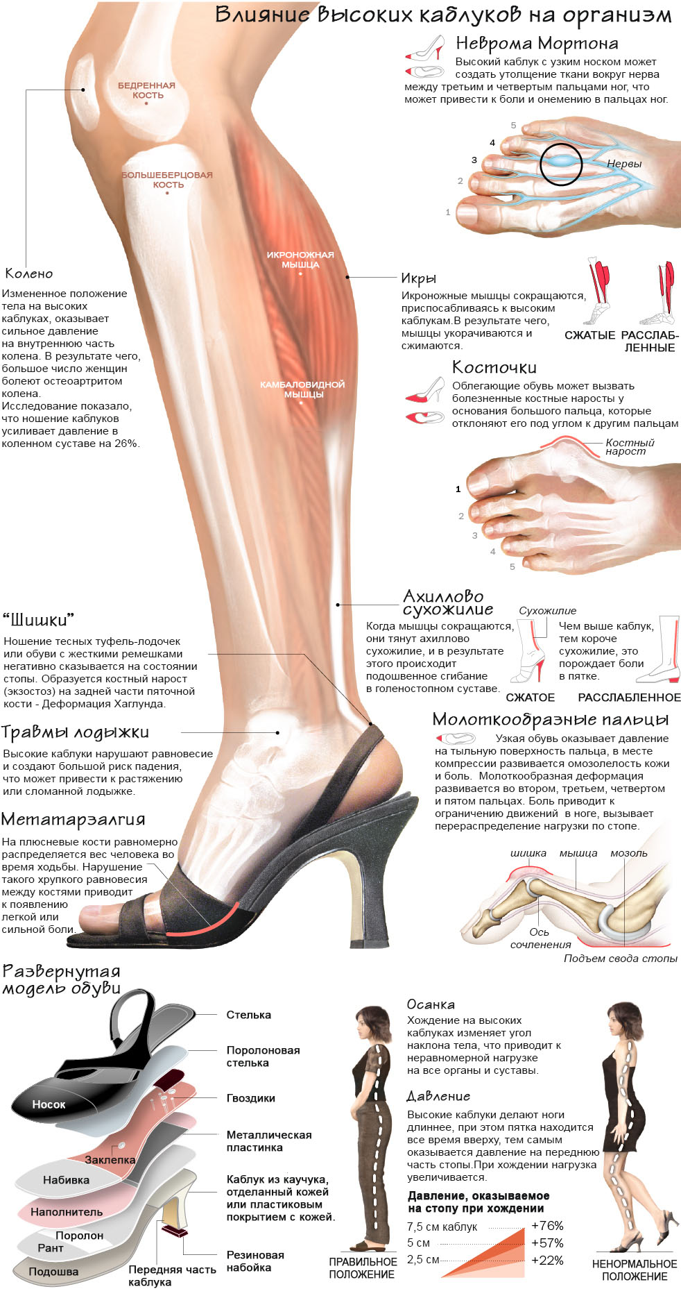 High heels can be a pain in the feet